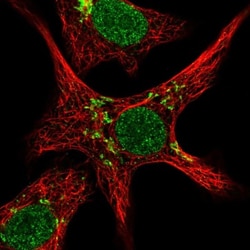 ZNF526 Antibody, Novus Biologicals:Antibodies:Primary Antibodies